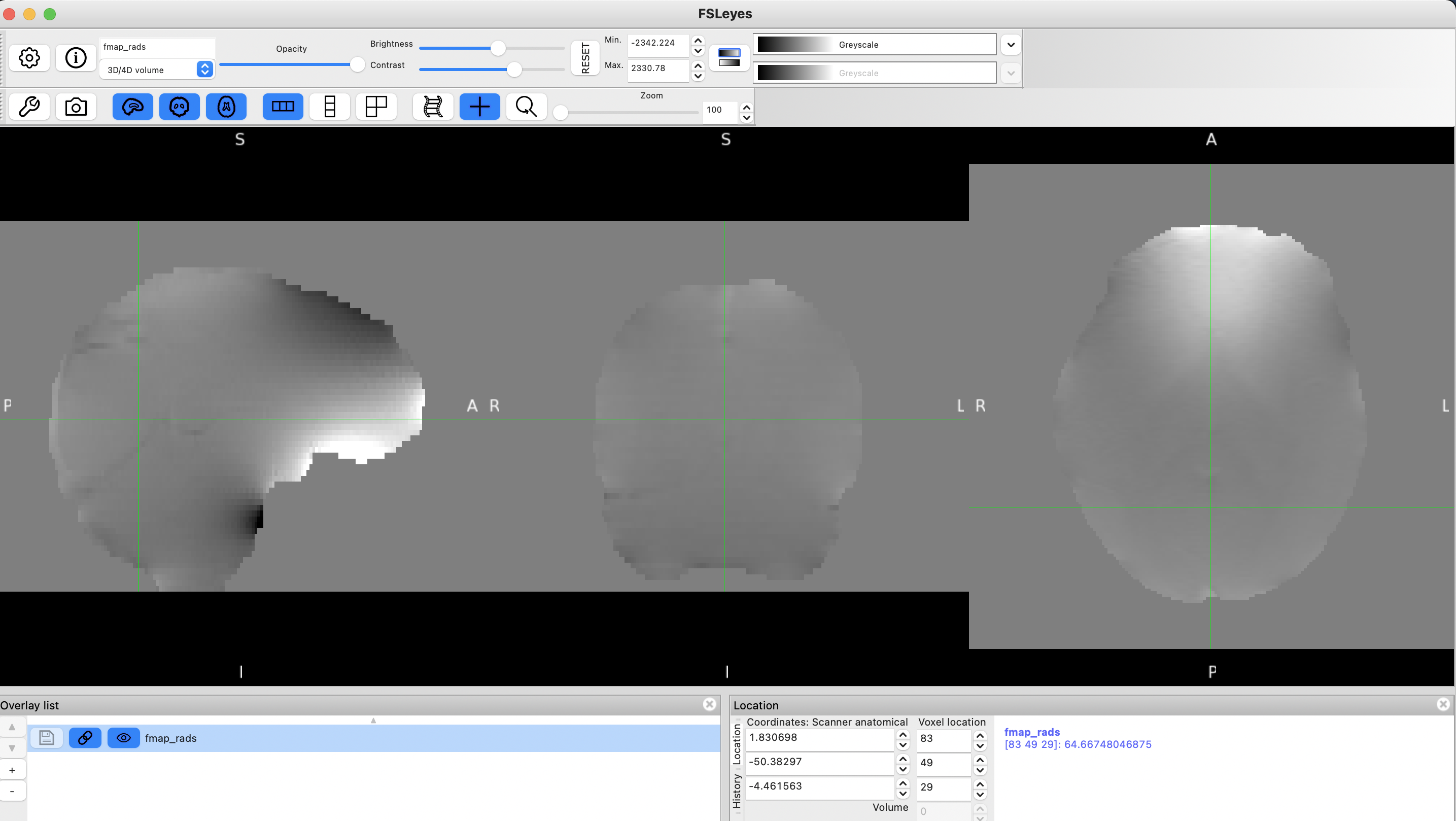 Fieldmap in rad/s Example