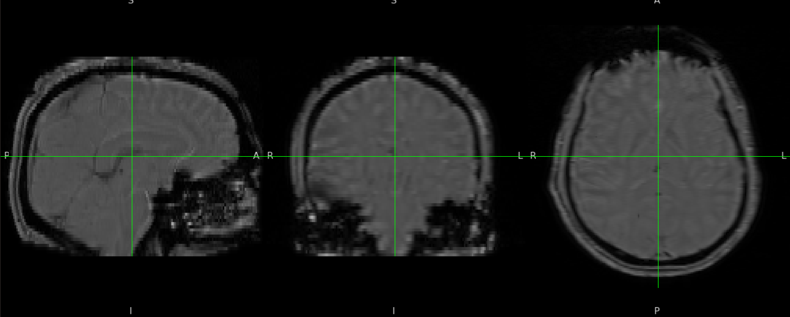 Magnitude Image Example