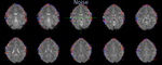 How to clean fMRI data with FIX-ICA
